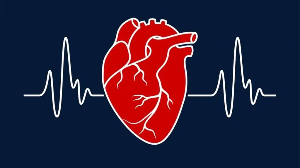 metode de diagnosticare a bolilor cardiovasculare