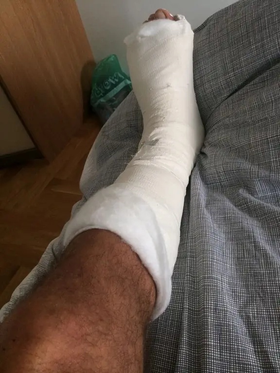 leg after surgery