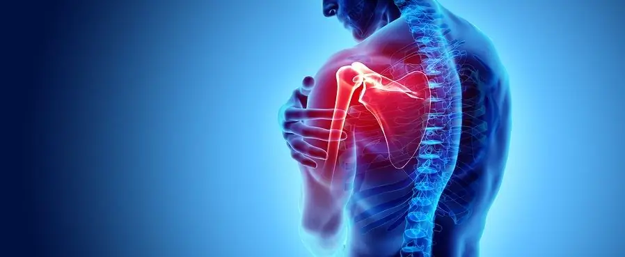 fracture of the surgical neck of the right humerus