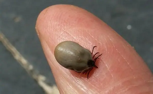 removing a tick from a person