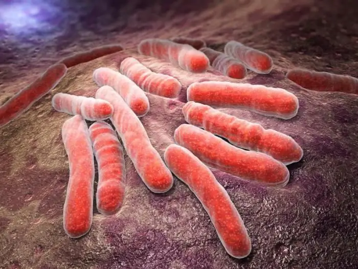 caseous pneumonia differential diagnosis