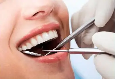 aanduidings vir tandekstraksie met periodontitis