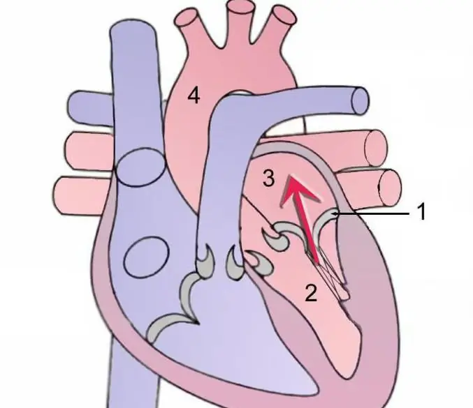 የ tricuspid valve ያልተሟላ መዘጋት