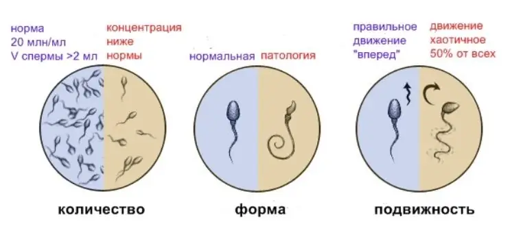 Analyse de sperme