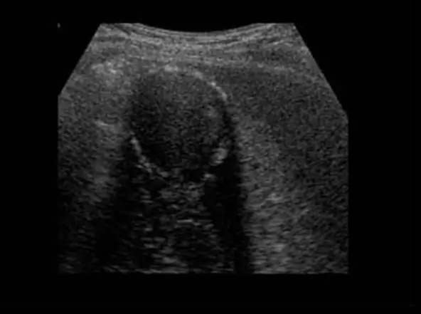 Deskripsi pekerjaan dokter diagnostik ultrasound