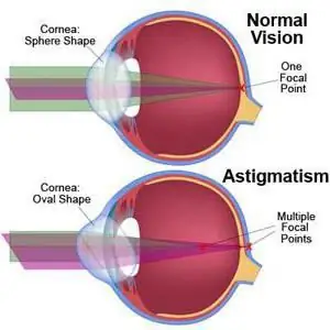 lentes de contato tóricas