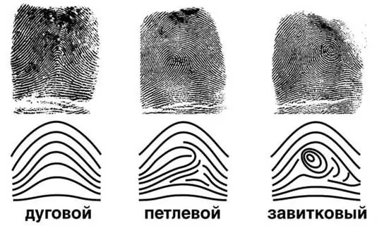 papillary patterns