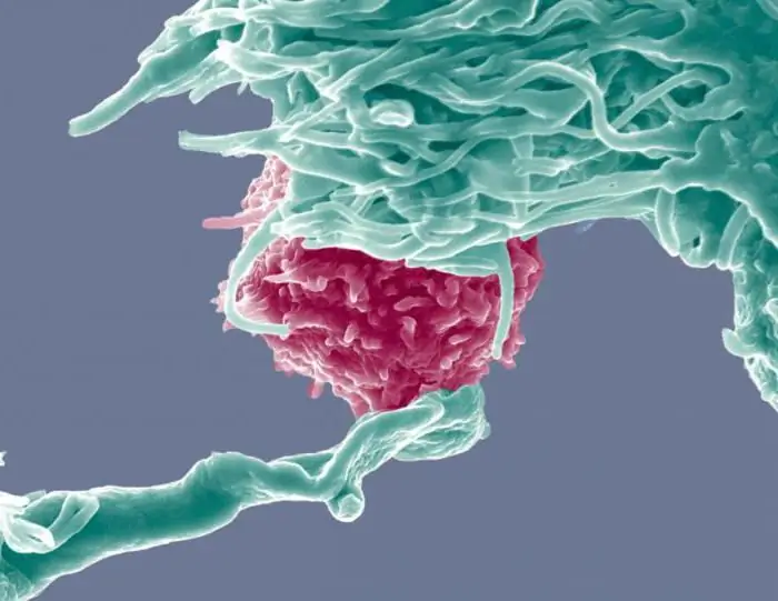 trattamento del cancro con cellule dendritiche