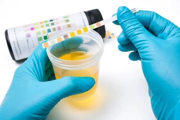 urinalysis in children is normal