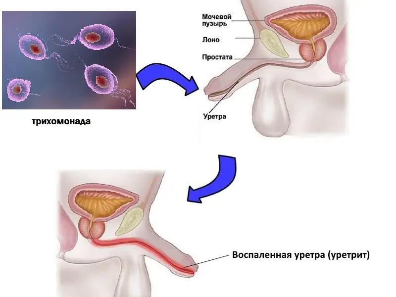 why do men have pain when urinating remedy for pain when urinating in men