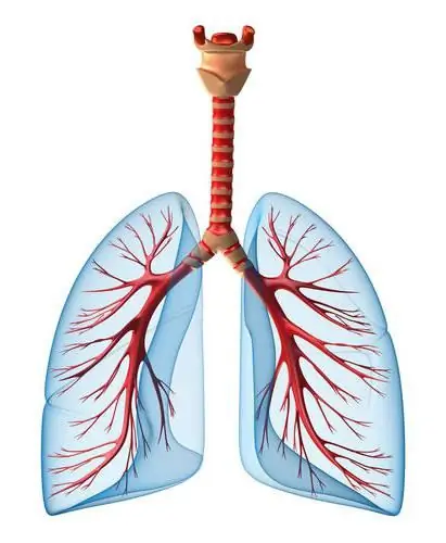 neumonía oculta en niños