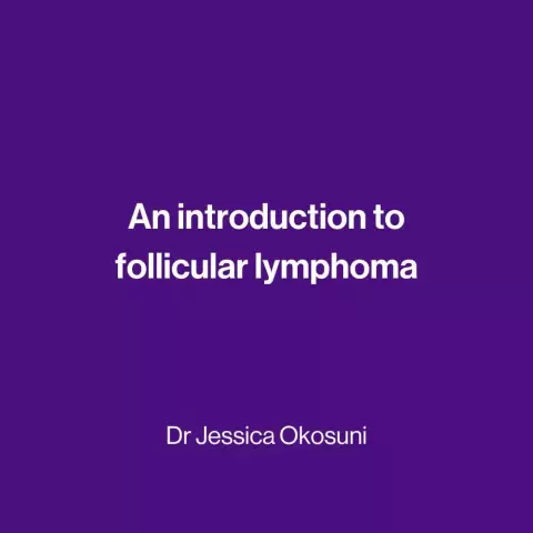 Follicular lymphoma: symptoms, causes, treatment. Remission and relapse of follicular lymphoma