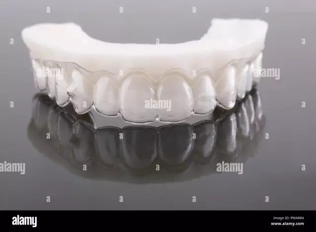 Couronnes en céramique sur les dents de devant