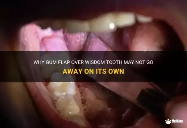 Why the gum moves away from the tooth and how to put it back in place