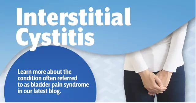 Acute cystitis - causes, symptoms and treatment