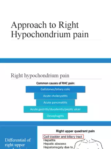 When does pain in the right hypochondrium radiate to the back?