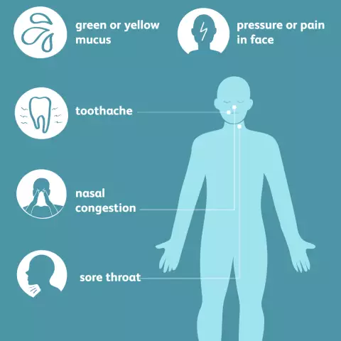 Treatment of sinusitis in children