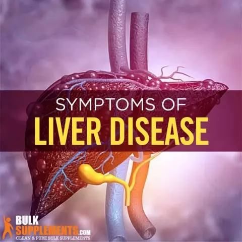 Liver disease: symptoms and treatment. Liver hurts: causes