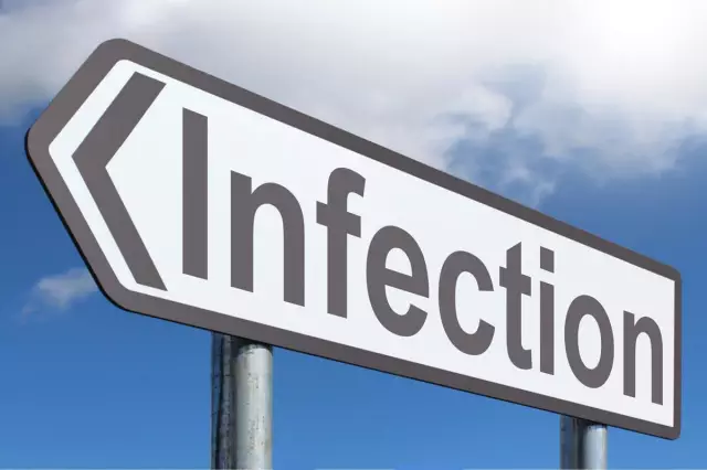 Mycoplasmes chez la femme. Modes d'infection et signes