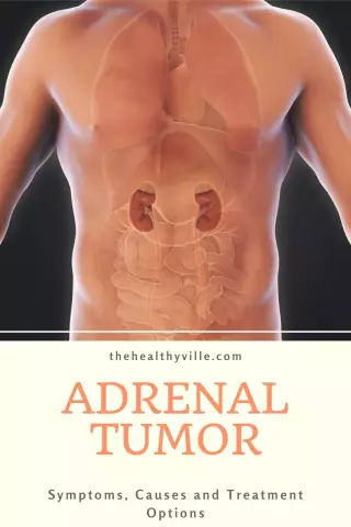 Hyperfunction of the adrenal glands: causes, symptoms, diagnosis and treatment