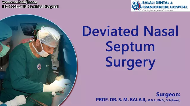 Deviated septum: surgery and treatment