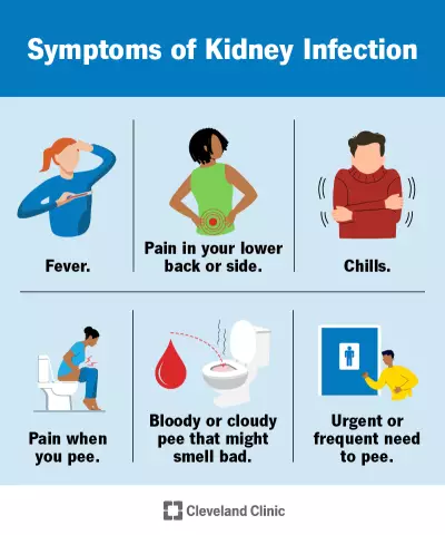 Acute and chronic pyelonephritis: symptoms in men. Treatment