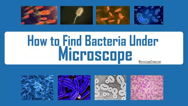 Bacteria and microbes under a microscope (photo)