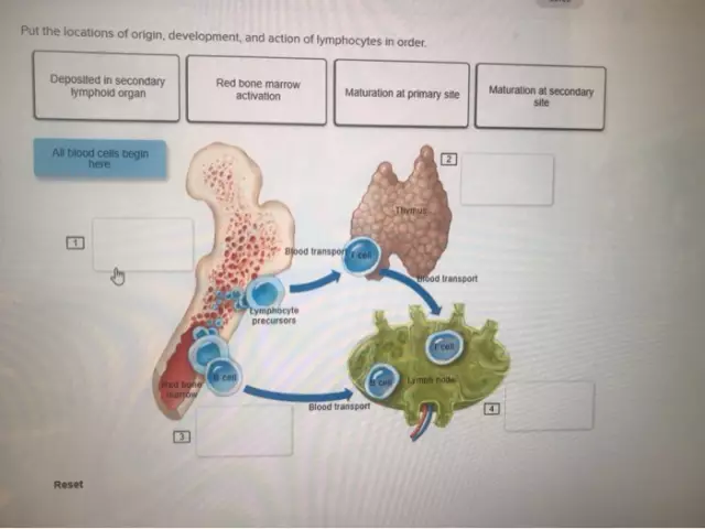 Increased lymphocytes in the blood of a child