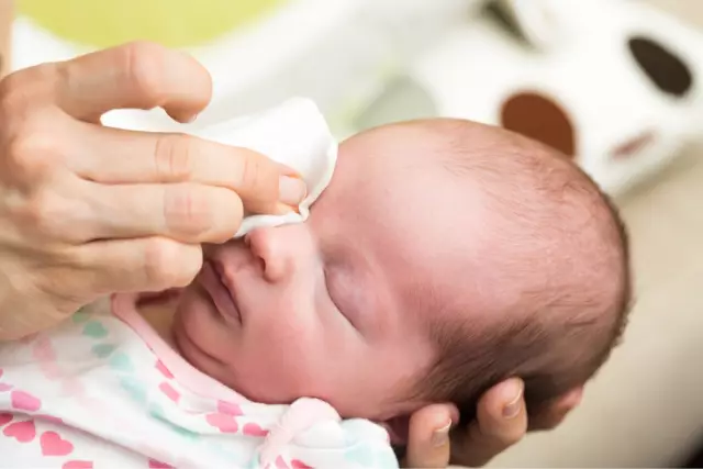 ¿Qué es la conjuntivitis? Síntomas, causas y tratamiento de la conjuntivitis