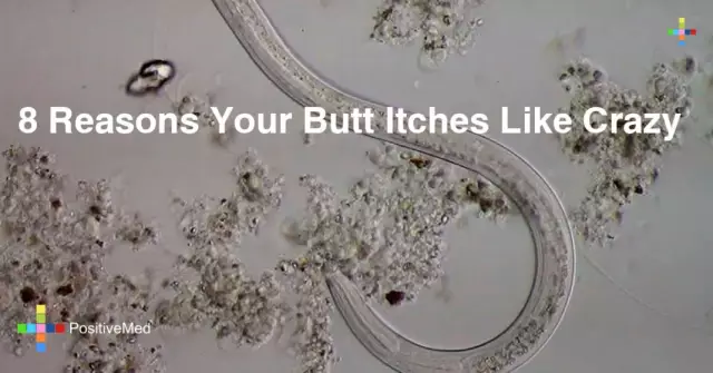 If the butt itches - is this a sign of illness?