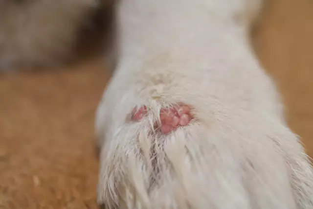 What is papilloma? Removal at home by folk methods