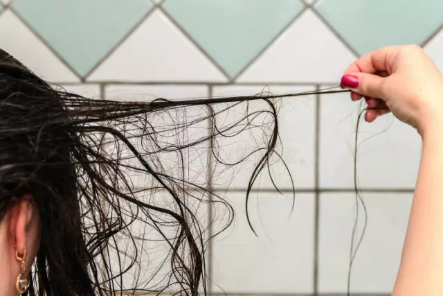 How and why hair falls out on the head of women