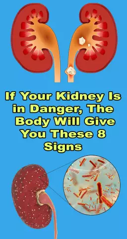 How kidneys hurt: signs and symptoms. How to understand that the kidneys hurt?