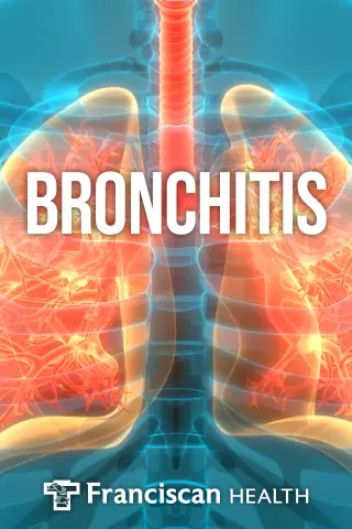 How is bronchitis treated without antibiotics?