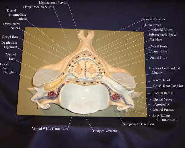 How to treat s alt deposits in the cervical region