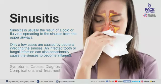 Complications of sinusitis. Symptoms, treatment and consequences of sinusitis