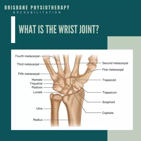 How to choose an orthosis for the wrist joint: advice and feedback from doctors