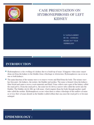 Hydronephrosis of the left kidney: etiology and signs