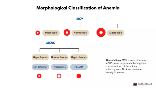 Anemia 1 degree