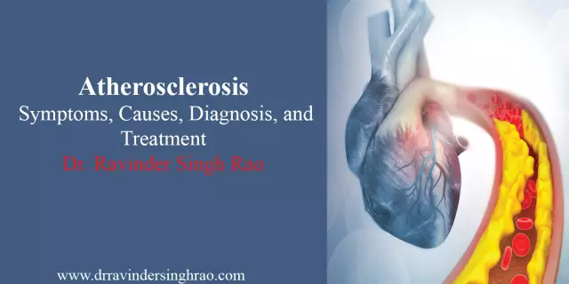 Treatment of atherosclerosis of the vessels of the lower extremities and symptoms of the disease