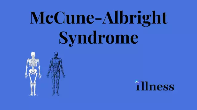 Albright Syndrome. McCune-Albright-Braytsev syndrome. Mga sanhi, paggamot