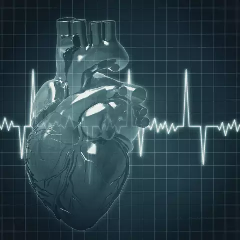 Cardiac arrhythmia. Signs. Causes