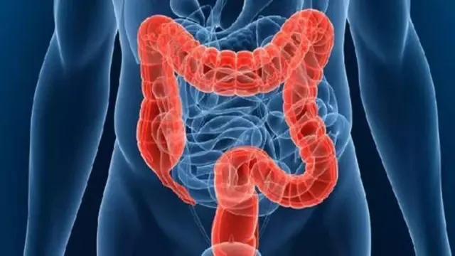 Gas formation in the intestines: the causes of flatulence