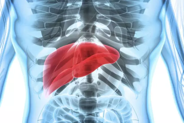 What to do when the spleen hurts? Symptoms and treatment