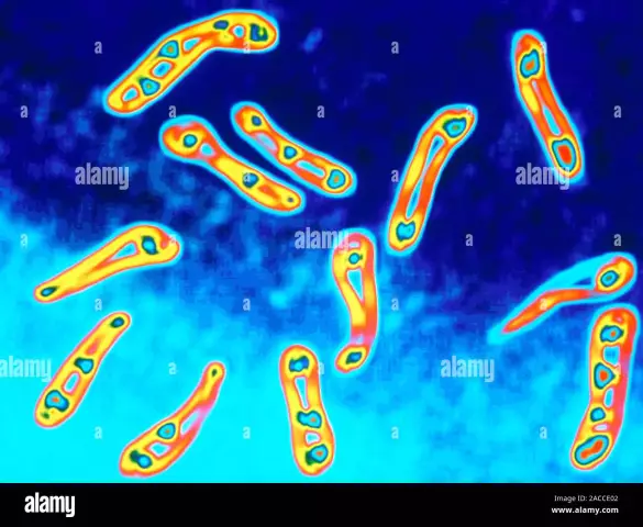 Infectious diseases: the causative agent of diphtheria