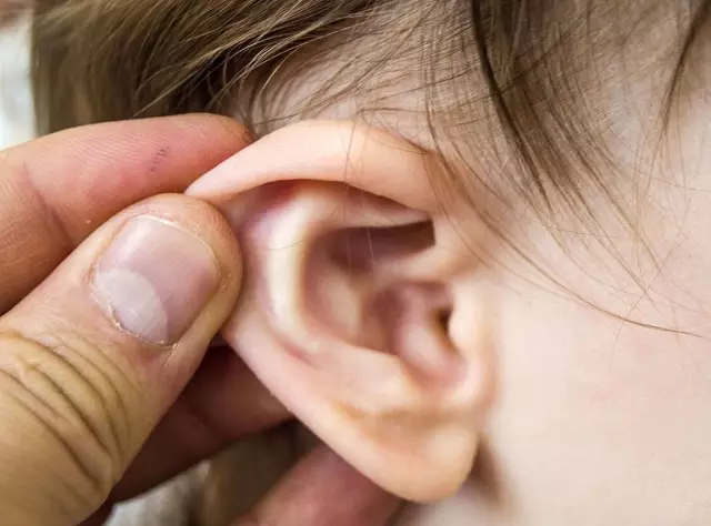 Drops in the ears with otitis media for adults and children