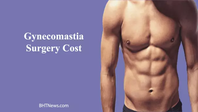 Gynecomastia removal: surgery and rehabilitation