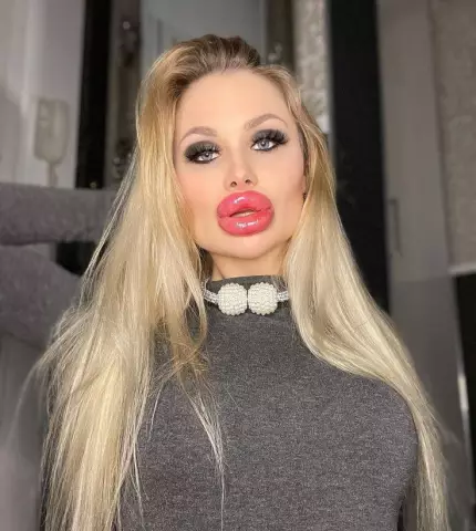 Plastic lips - a modern way of correction