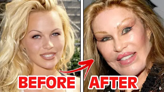 Victims of plastic surgery: before and after (photo)