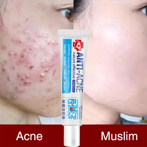 Crema d'acne "Tretinoïna": comentaris. Quina eficàcia de la "tretinoïna"?